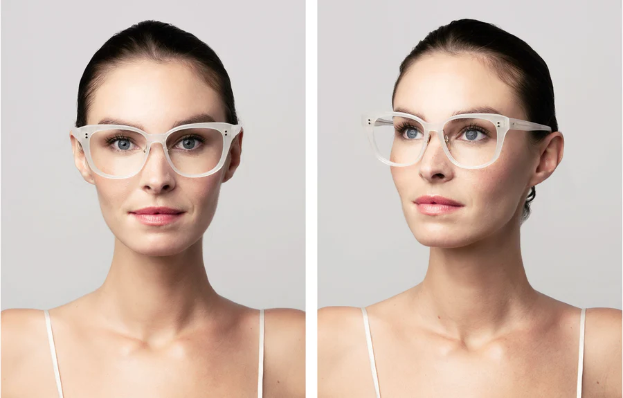 Dita Erahdu 03 Ice Eyes Optometry elbourne